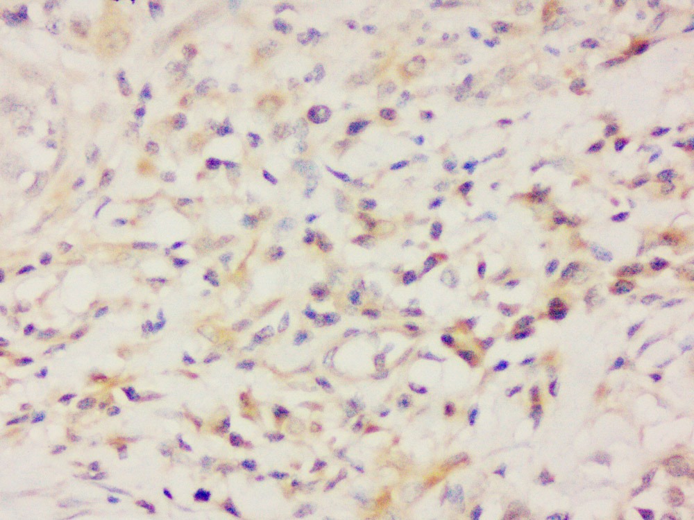 Anti-Aquaporin-5/AQP5 Polyclonal Antibody