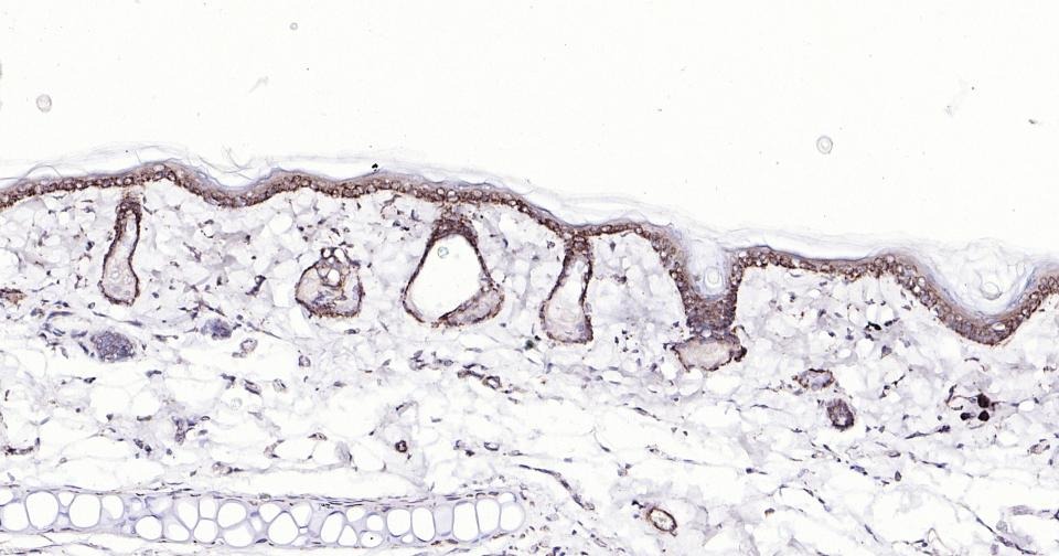 Anti-BAX Antibody (5X827)