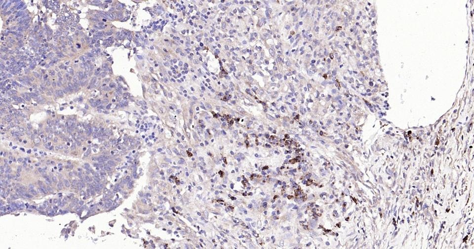 Anti-BAX Antibody (5X827)