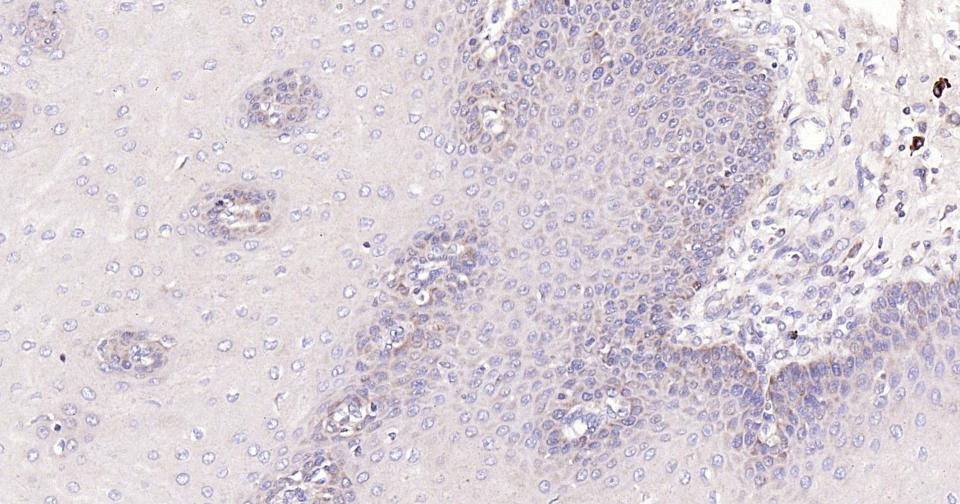 Anti-BAX Antibody (5X827)