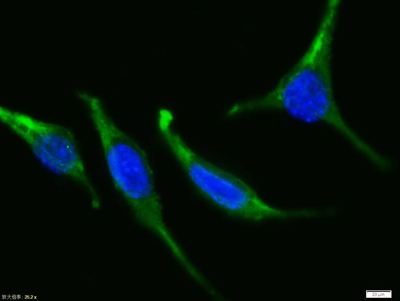 Anti-BAX Polyclonal Antibody 2