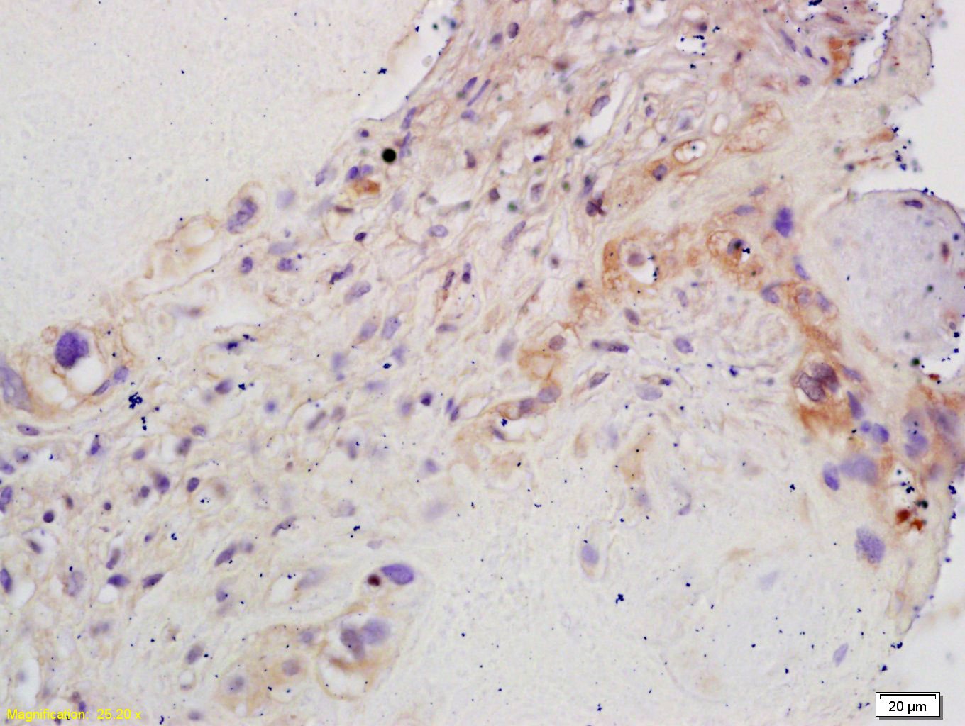 Anti-Aromatase/CYP19A1 Polyclonal Antibody 2