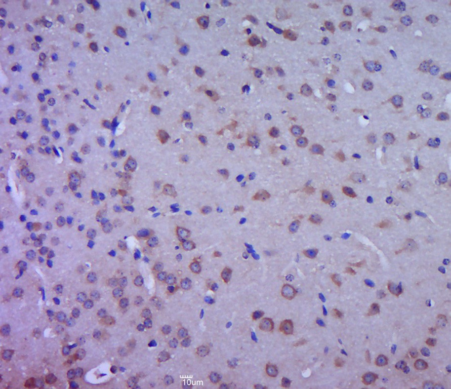 Anti-Aromatase/CYP19A1 Polyclonal Antibody