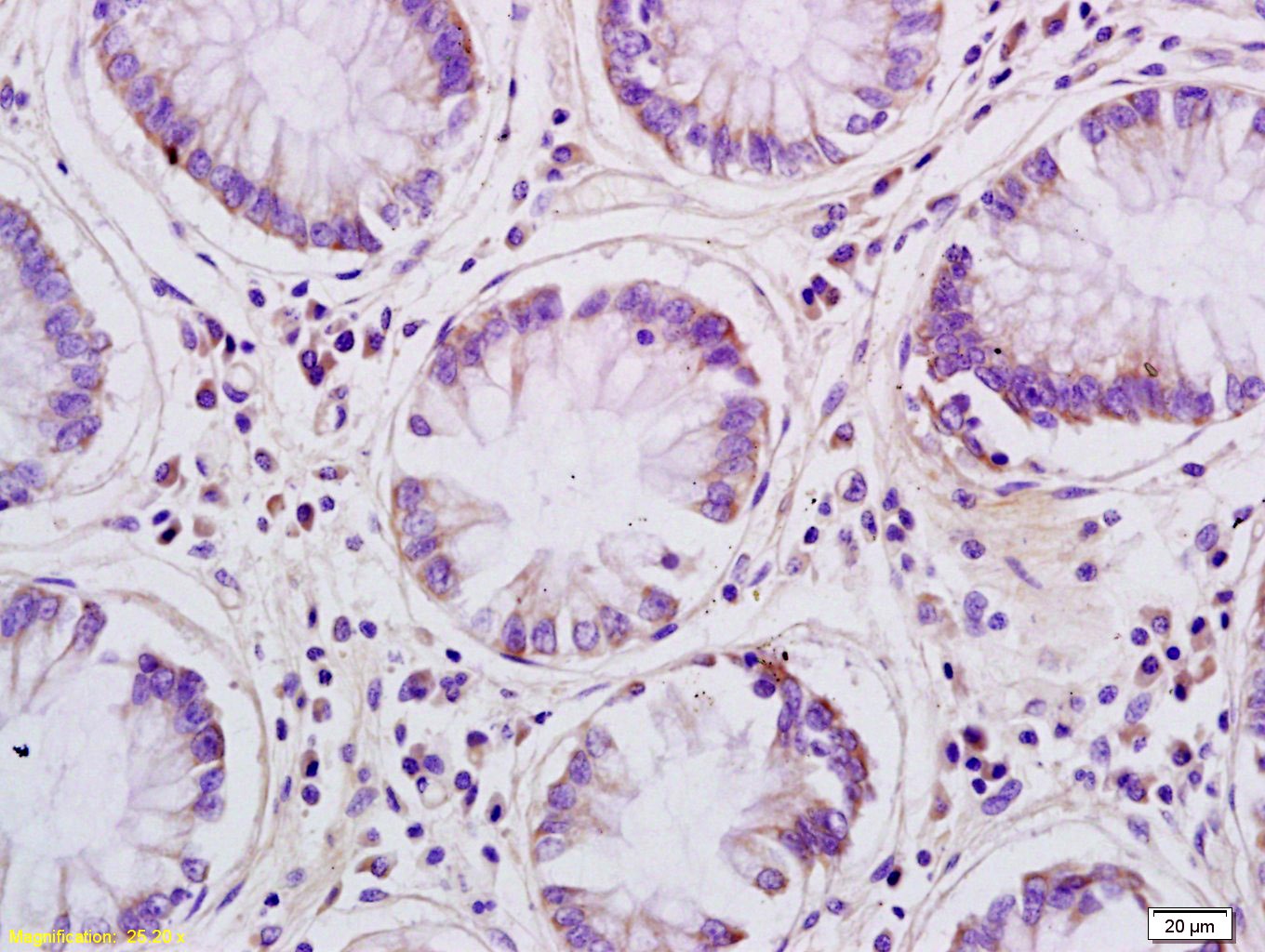 Anti-Aquaporin-8/AQP8 Polyclonal Antibody