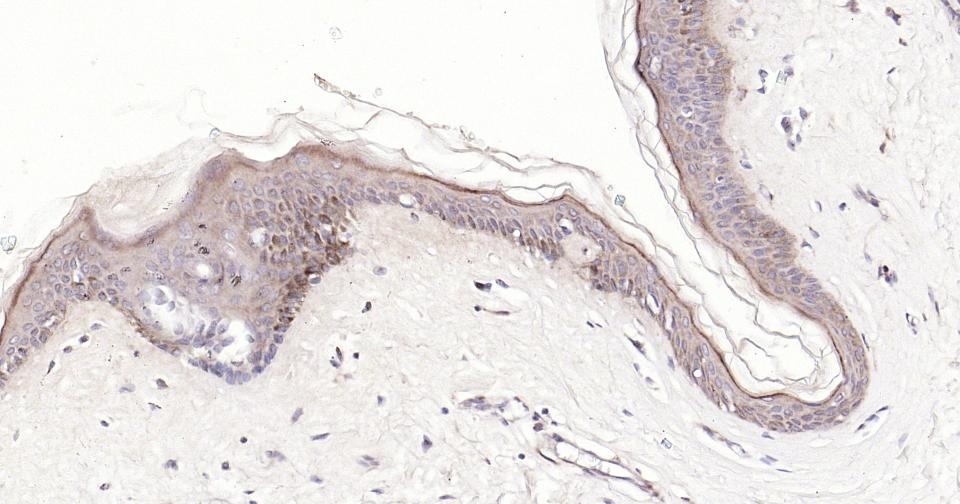 Anti-BAX Antibody (5X827)