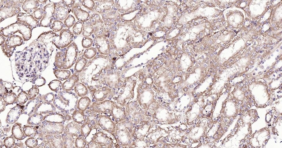 Anti-BAX Antibody (5X827)