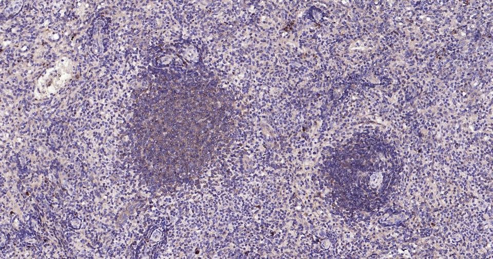 Anti-BAX Antibody (5X827)