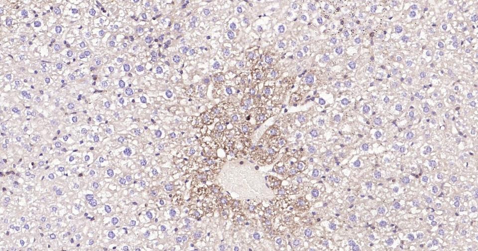 Anti-BAX Antibody (5X827)