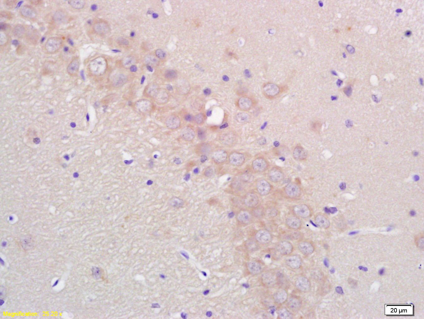 Anti-Aromatase/CYP19A1 Polyclonal Antibody 2