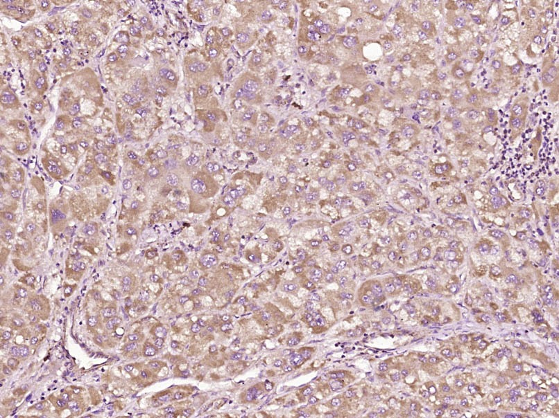 Anti-BAX Polyclonal Antibody 2