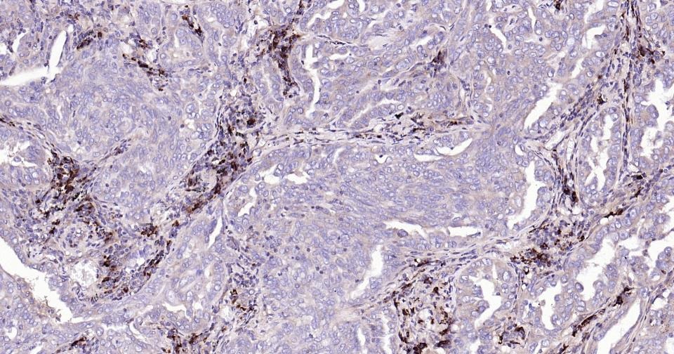 Anti-BAX Antibody (5X827)
