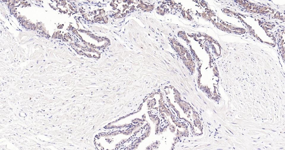 Anti-BAX Antibody (5X827)