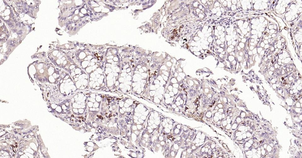 Anti-Beclin-1 Antibody (8U829)