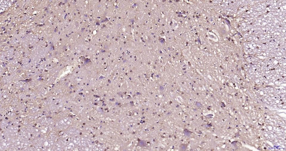 Anti-BDNF Polyclonal Antibody 3