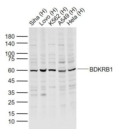 Anti-BDKRB1 Polyclonal Antibody