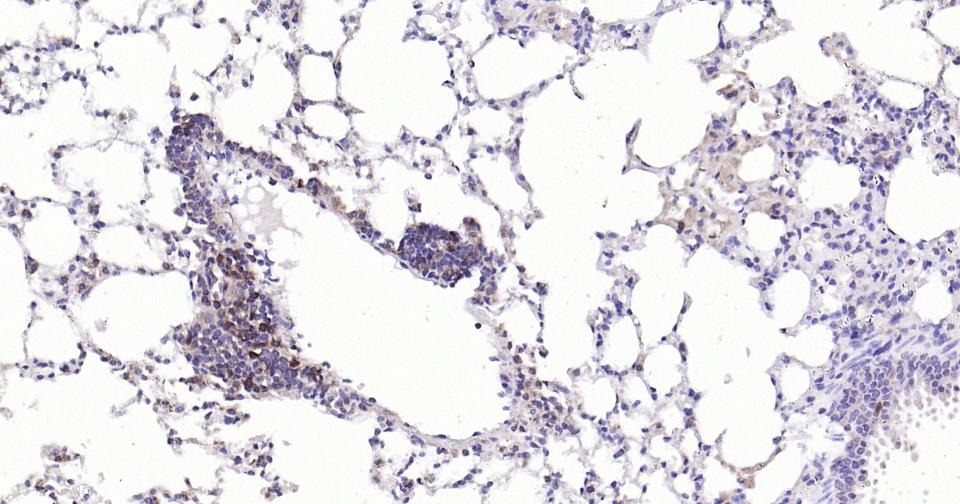 Anti-Caspase-3 Antibody (1B38)