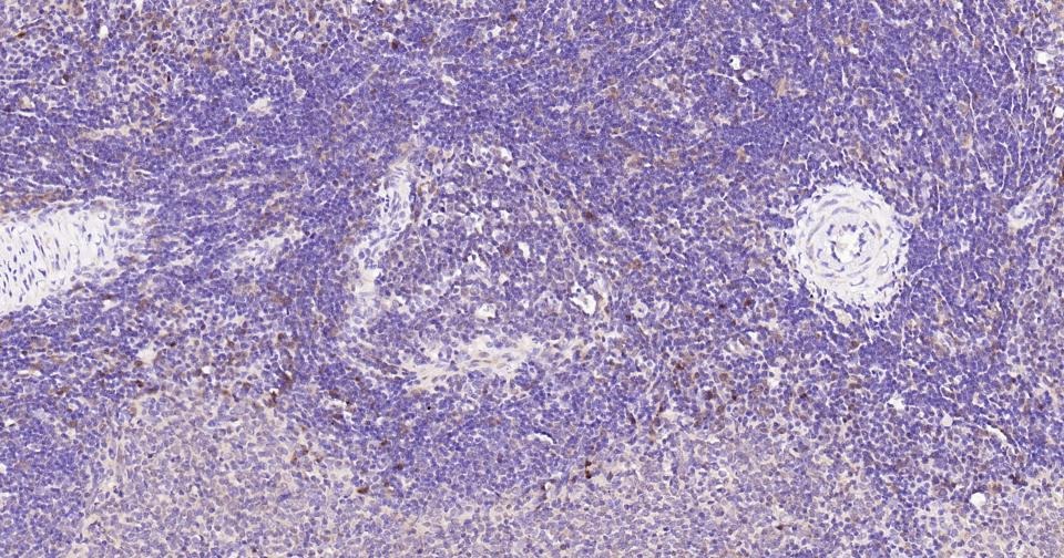 Anti-Caspase-3 Antibody (1B38)