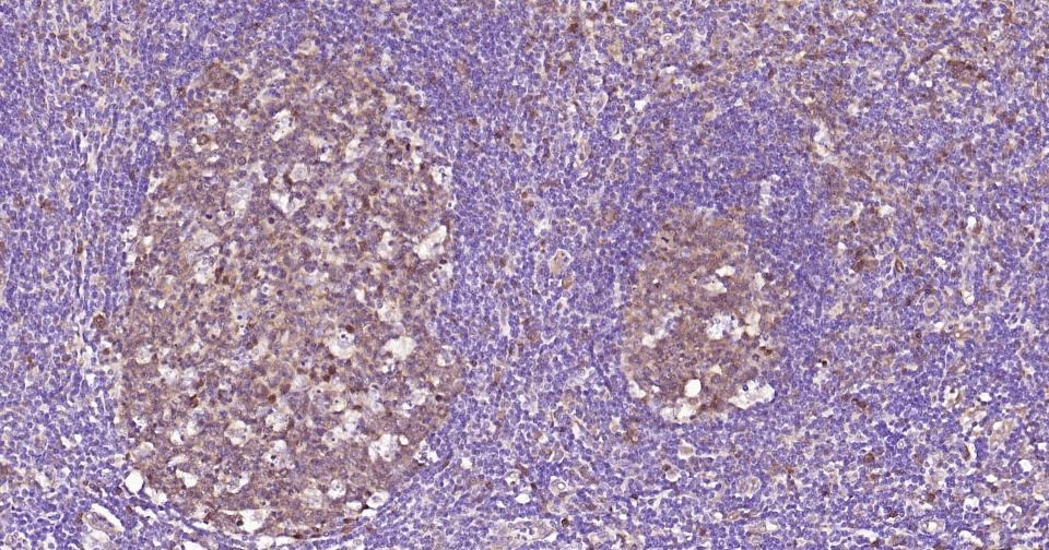 Anti-Caspase-3 Antibody (1B38)