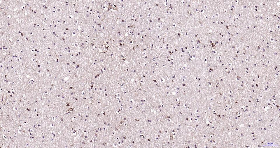Anti-BDNF Polyclonal Antibody 3