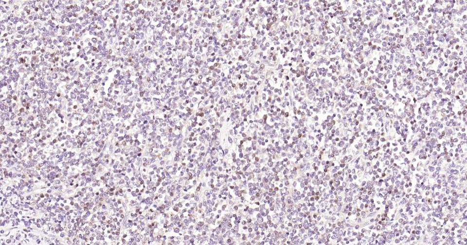 Anti-Caspase-3 Antibody (2P196)