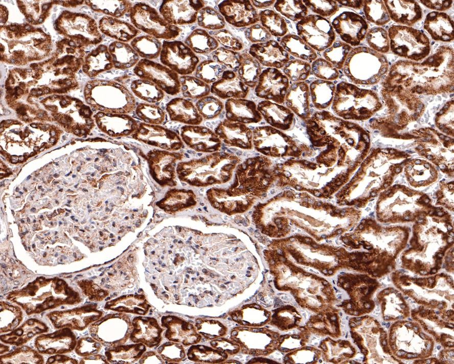 Anti-BCL2A1 Antibody (2U316)