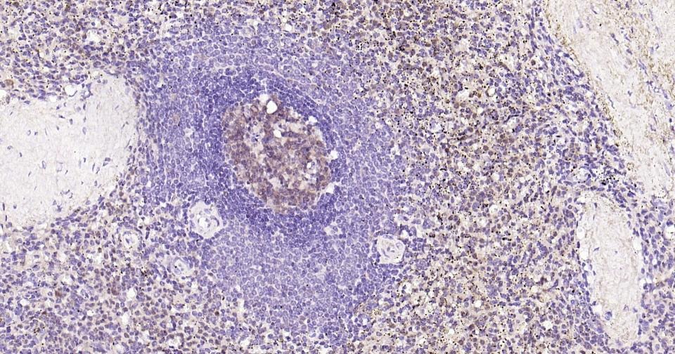 Anti-Caspase-3 Antibody (2P196)