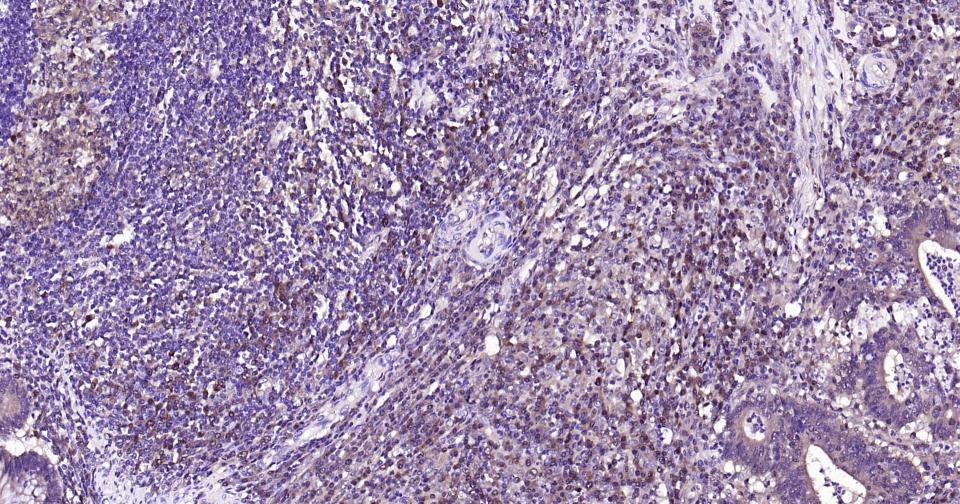Anti-Caspase-3 Antibody (1B38)