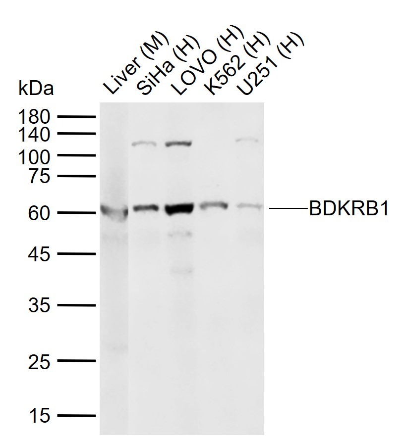 Anti-BDKRB1 Polyclonal Antibody