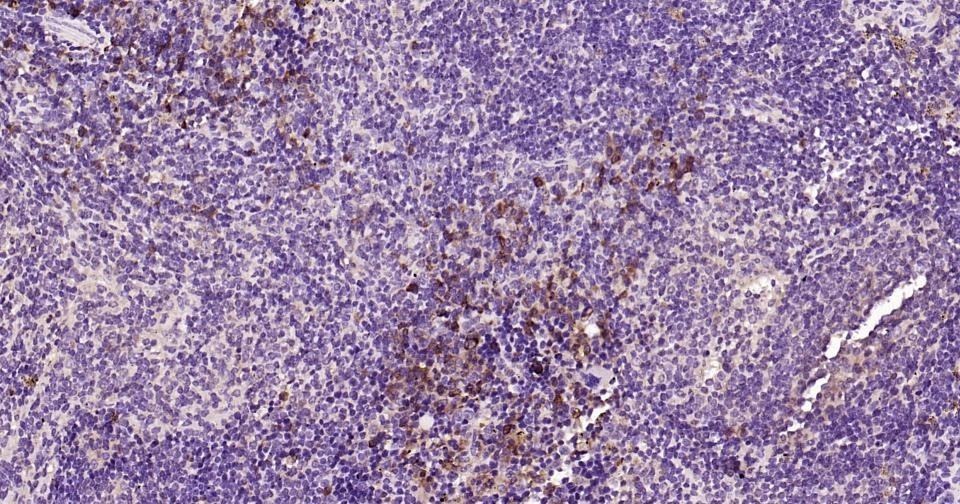 Anti-Beclin-1 Antibody (8U829)