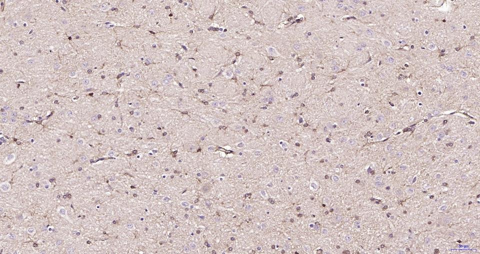 Anti-BDNF Polyclonal Antibody 3