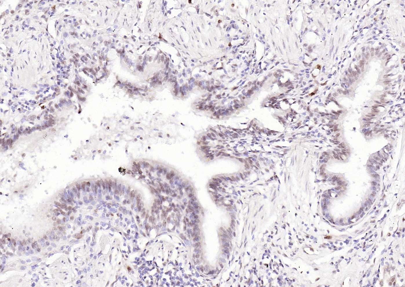 Anti-BCL6 Polyclonal Antibody