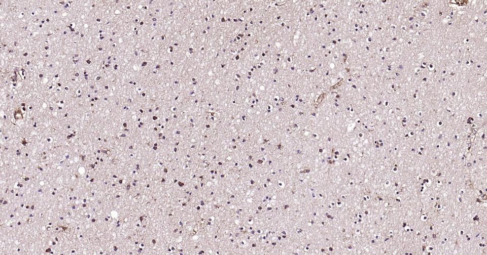 Anti-BDNF Antibody (1R78)
