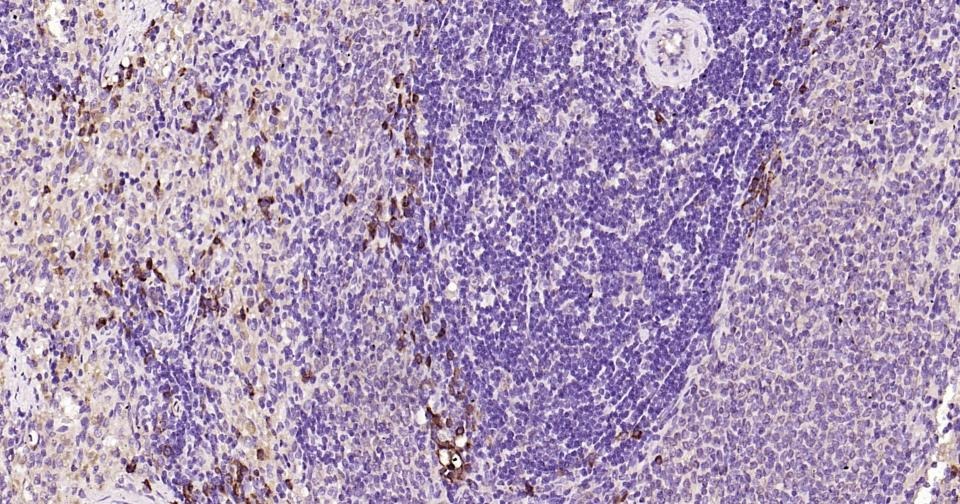 Anti-Beclin-1 Antibody (8U829)