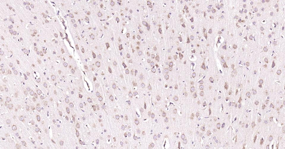 Anti-Beclin-1 Antibody (8U829)