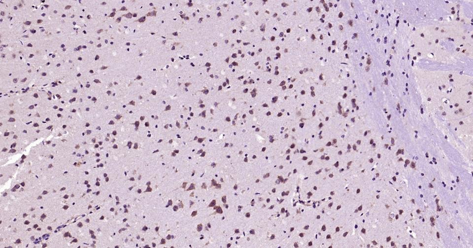 Anti-Beclin-1 Polyclonal Antibody