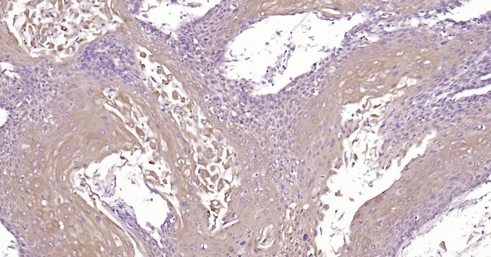 Anti-Beclin-1 Antibody (8U829)