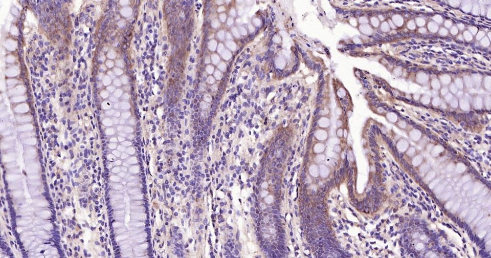 Anti-Beclin-1 Polyclonal Antibody