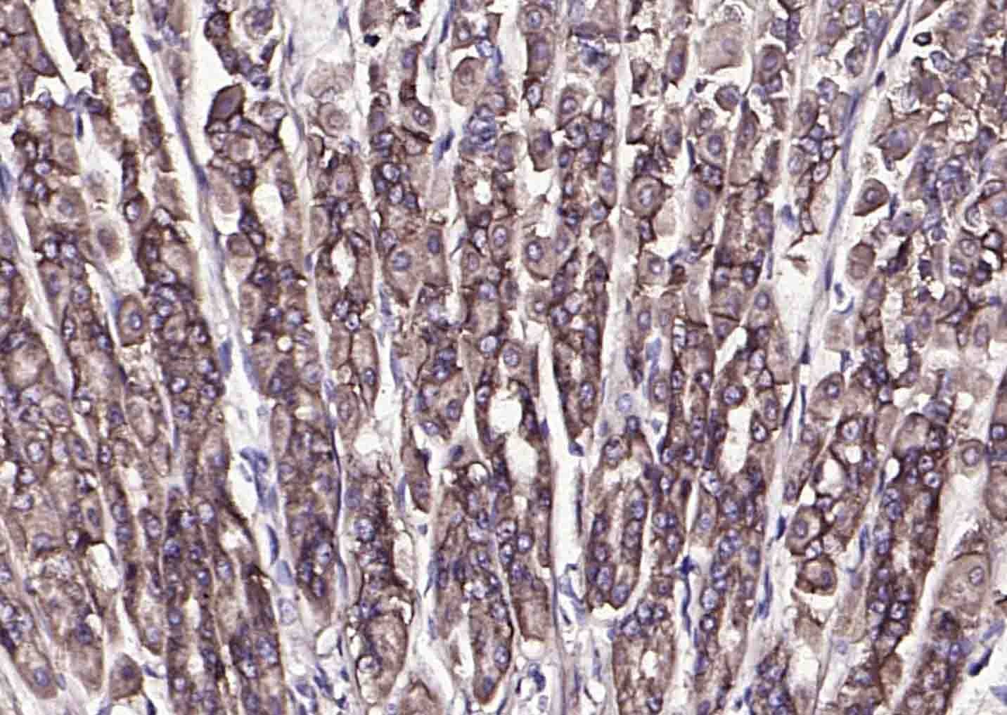 Anti-CA9/Carbonic Anhydrase IX Polyclonal Antibody