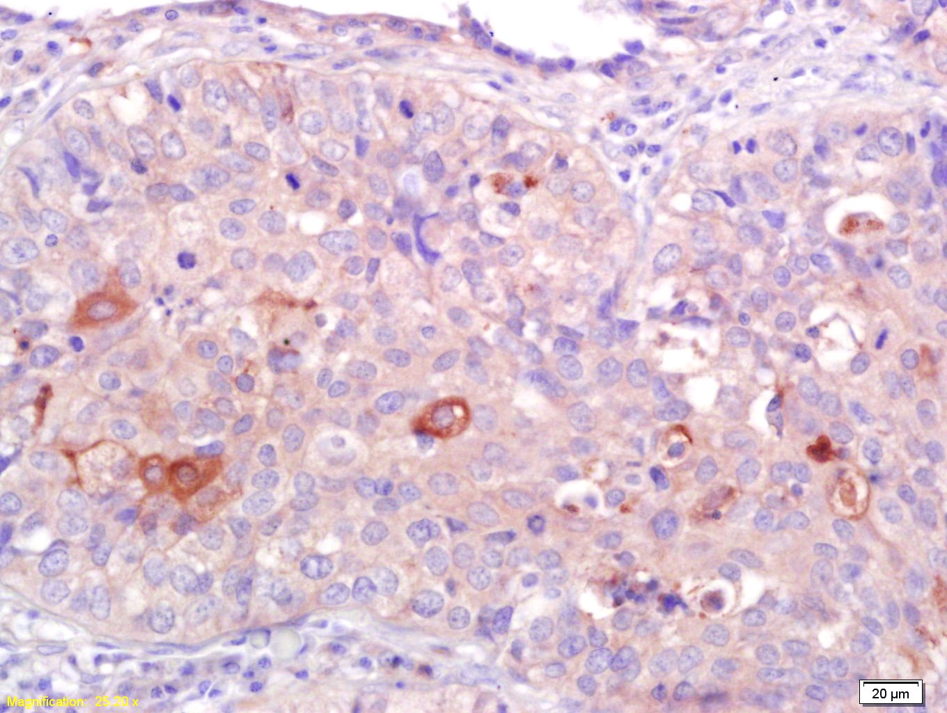 Anti-CB2/CNR2 Polyclonal Antibody