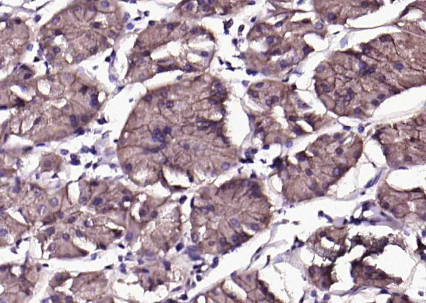 Anti-CA9/Carbonic Anhydrase IX Polyclonal Antibody