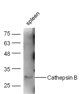 Anti-Cathepsin B Polyclonal Antibody