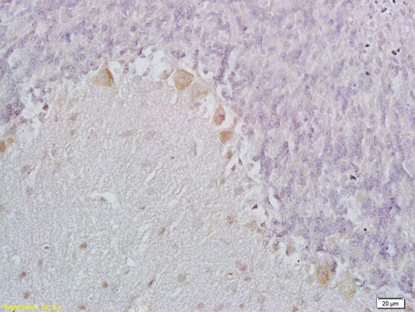 Anti-C1QL1 Polyclonal Antibody