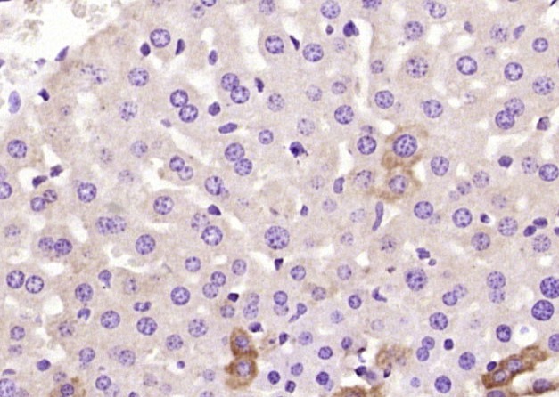 Anti-C1QC Polyclonal Antibody