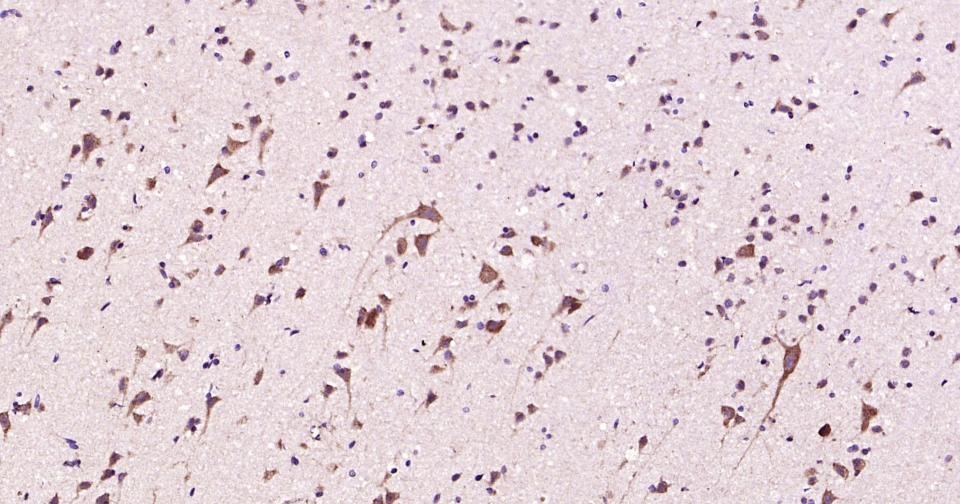 Anti-Beclin-1 Polyclonal Antibody
