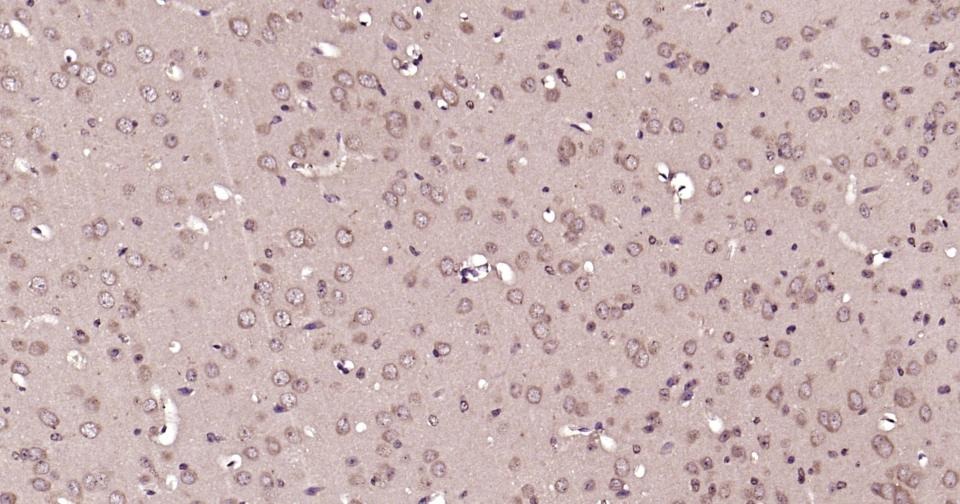 Anti-Beclin-1 Antibody (8U829)