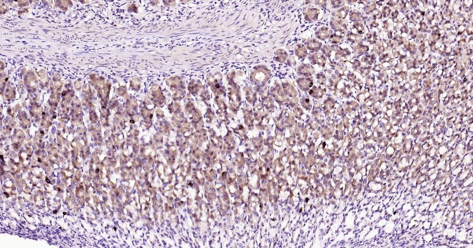 Anti-Beclin-1 Polyclonal Antibody