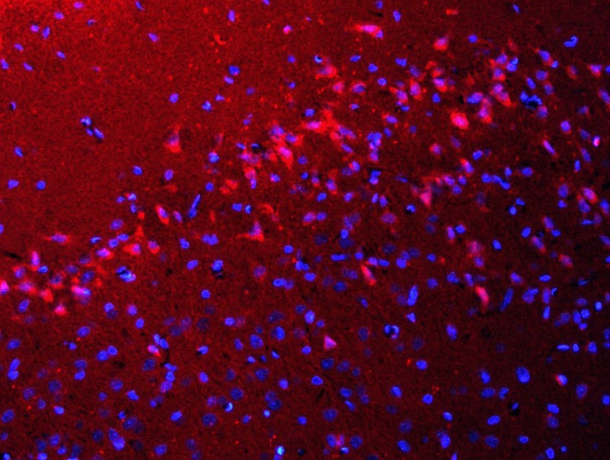 Anti-Beclin-1 Polyclonal Antibody