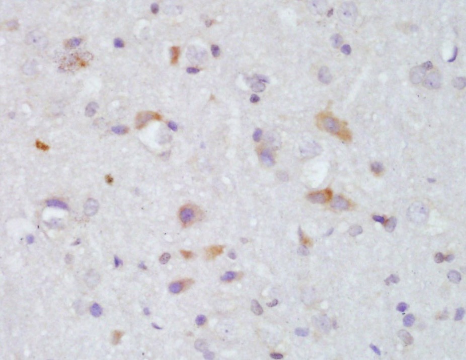 Anti-Catalase/CAT Polyclonal Antibody