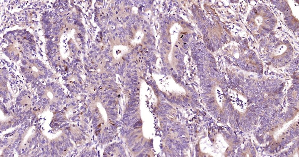 Anti-Beclin-1 Polyclonal Antibody