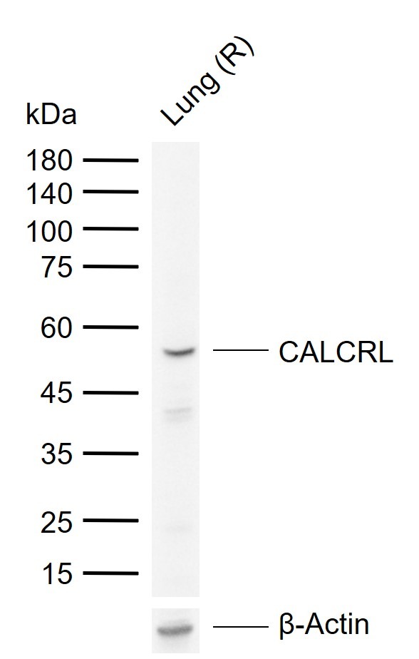 Anti-CALCRL Polyclonal Antibody